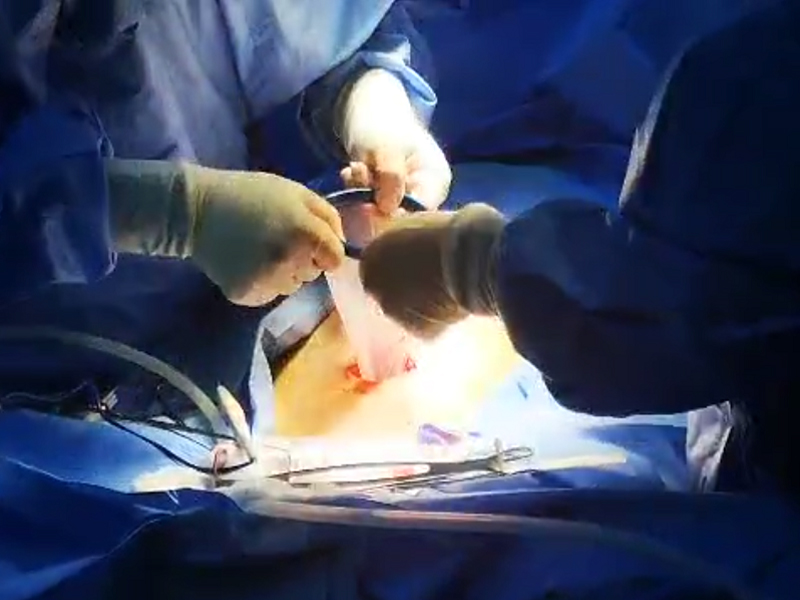 Surgical Access & Wound Protection Solution