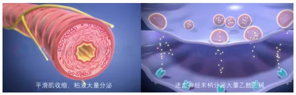 conference flash senscure pulmonary vagal nerve cryoablation cb tld surgically live streamed at shanghai east hospital conference flash senscure pulmonary vagal nerve cryoablation cb tld surgically live streamed at shanghai east hospital