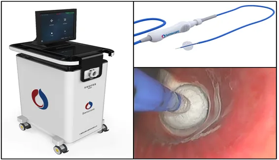 good news for asthma patients new technology new hope bronchoscopic cryoablation denervation bcd for severe asthma good news for asthma patients new technology new hope bronchoscopic cryoablation denervation bcd for severe asthma