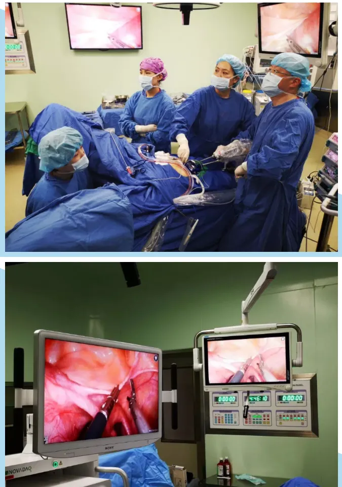 gynecologic single port laparoscopy training course 2019 renji south campus shanghai gynecologic single port laparoscopy training course 2019 renji south campus shanghai