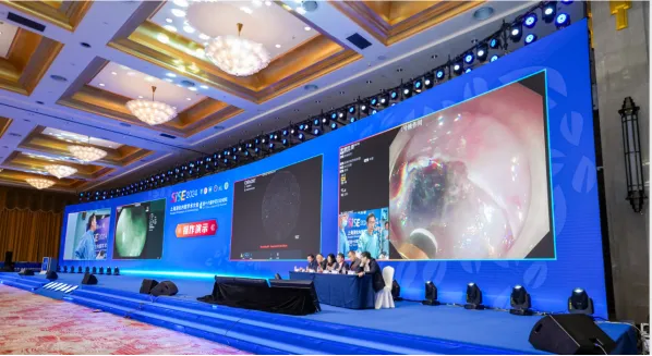 senscure showcases innovations at 2024 shanghai international digestive endoscopy symposium 16th china japan esd forum senscure showcases innovations at 2024 shanghai international digestive endoscopy symposium 16th china japan esd forum