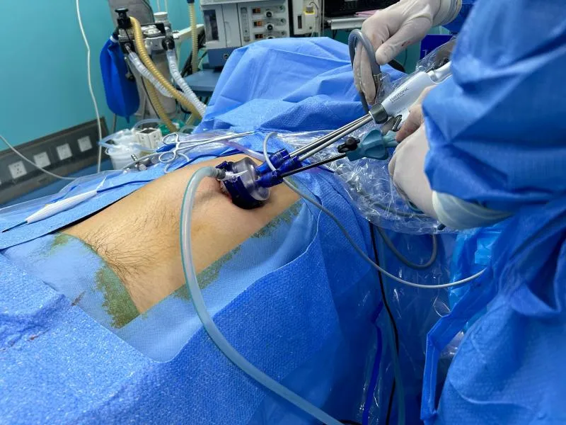 Single-Port Laparoscopic Surgery Solution Clinical Solutions