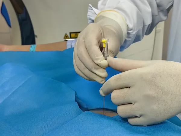 Pulmonary Nodules Localization Solution