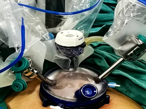 Key Benefits of Gel Multi-instrument Laparoscopic Access Platform