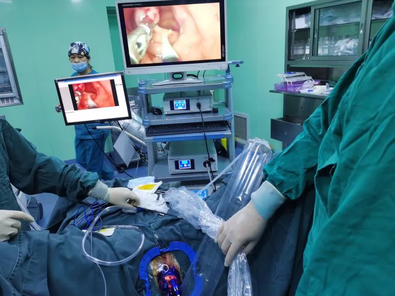 Single Port Laparoscopic Surgery Solution Transanal Clinical Solutions