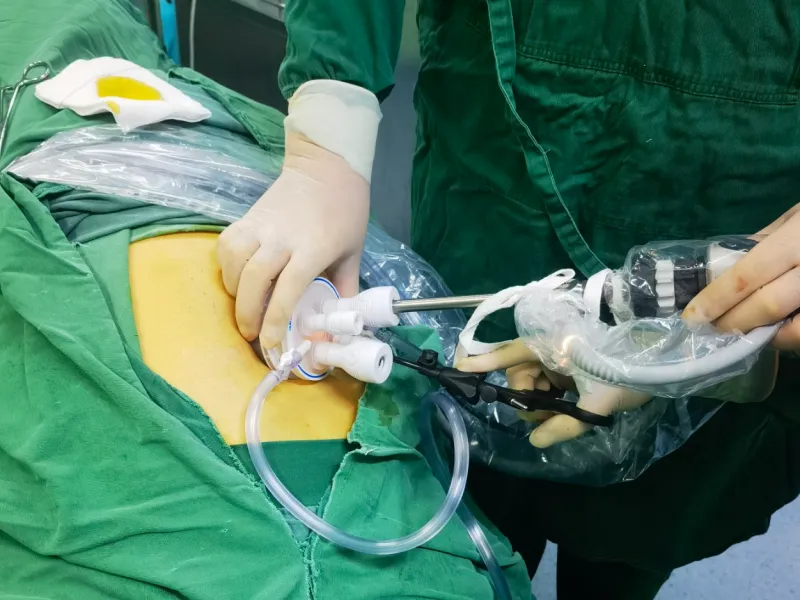 Surgical Access & Wound Protection Solution